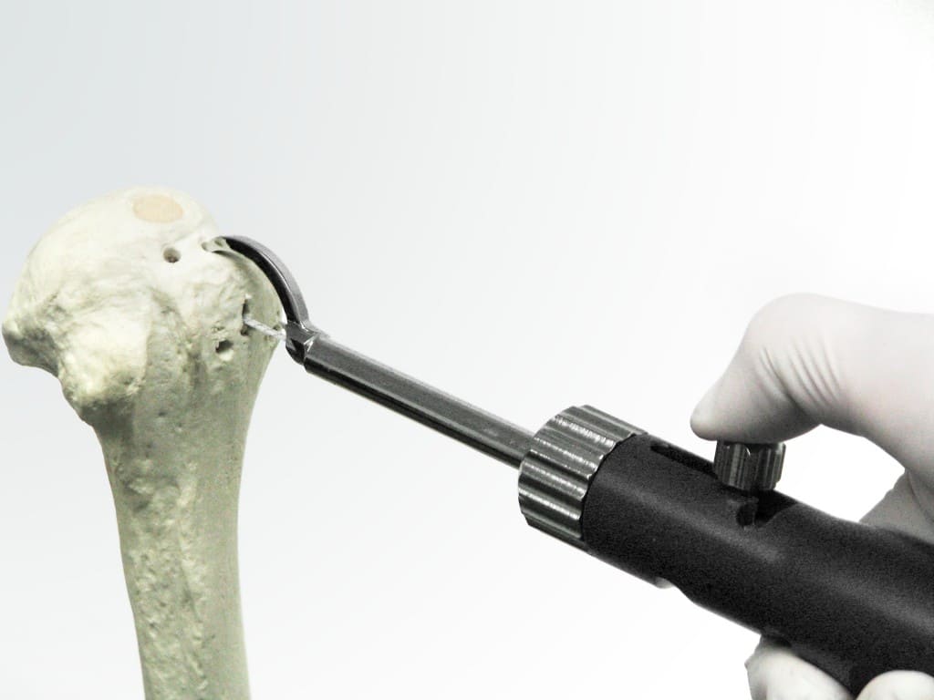 Arthroscopic or Open Repairs TransOS Tunneler:Orthopedic spine,Flat arthroscopy,Orthopedic surgery instrument