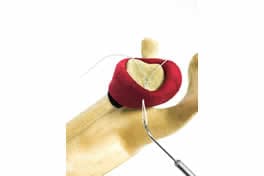 Directly Shuttle Suture VersaTip Suture Shuttle:Orthopedic c arm,Orthopedic ultrasound,Orthopedic hemostatic machine